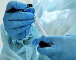 Число заболевших коронавирусом в Калмыкии увеличилось до 32