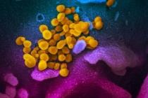 Учёные создали моментальный тест для определения коронавируса